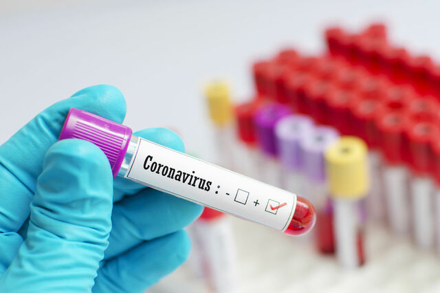 Häufig gestellte Fragen zum neuartigen Coronavirus