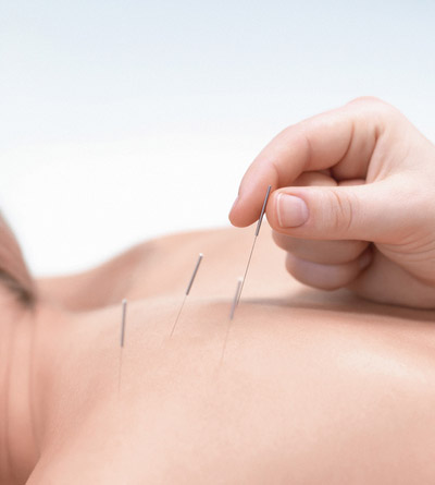 Schmerzlose Akupunktur im TRINICUM